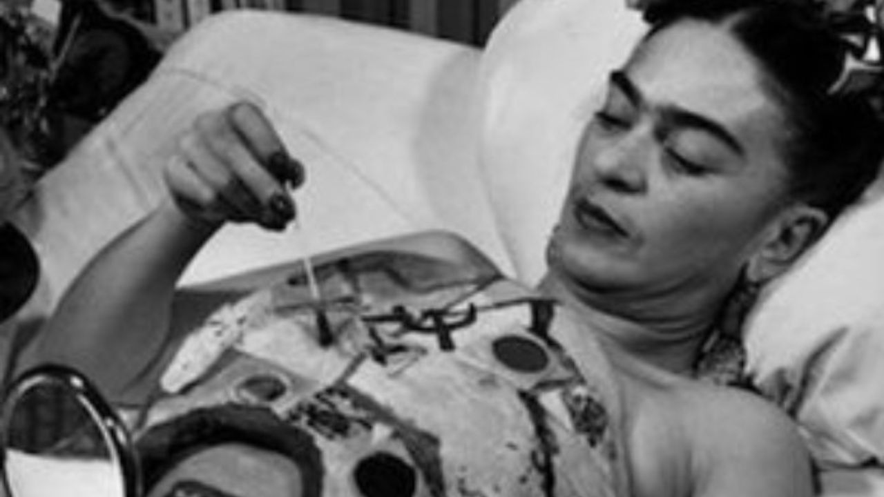Frida Kahlo dopo l'incidente