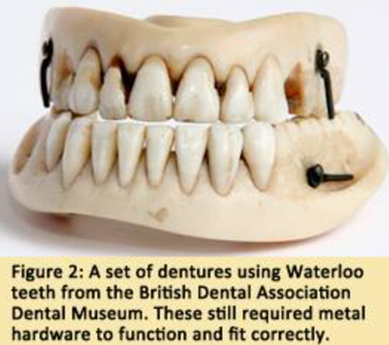 Denti immagine denti di Waterlo