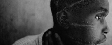 Foto del giorno: le cicatrici del genocidio in Ruanda