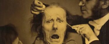 Foto del giorno: elettrostimolazione facciale