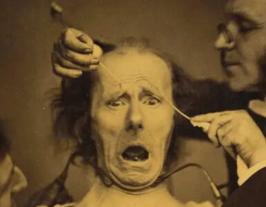 Foto del giorno: elettrostimolazione facciale