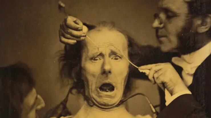 Foto del giorno: elettrostimolazione facciale