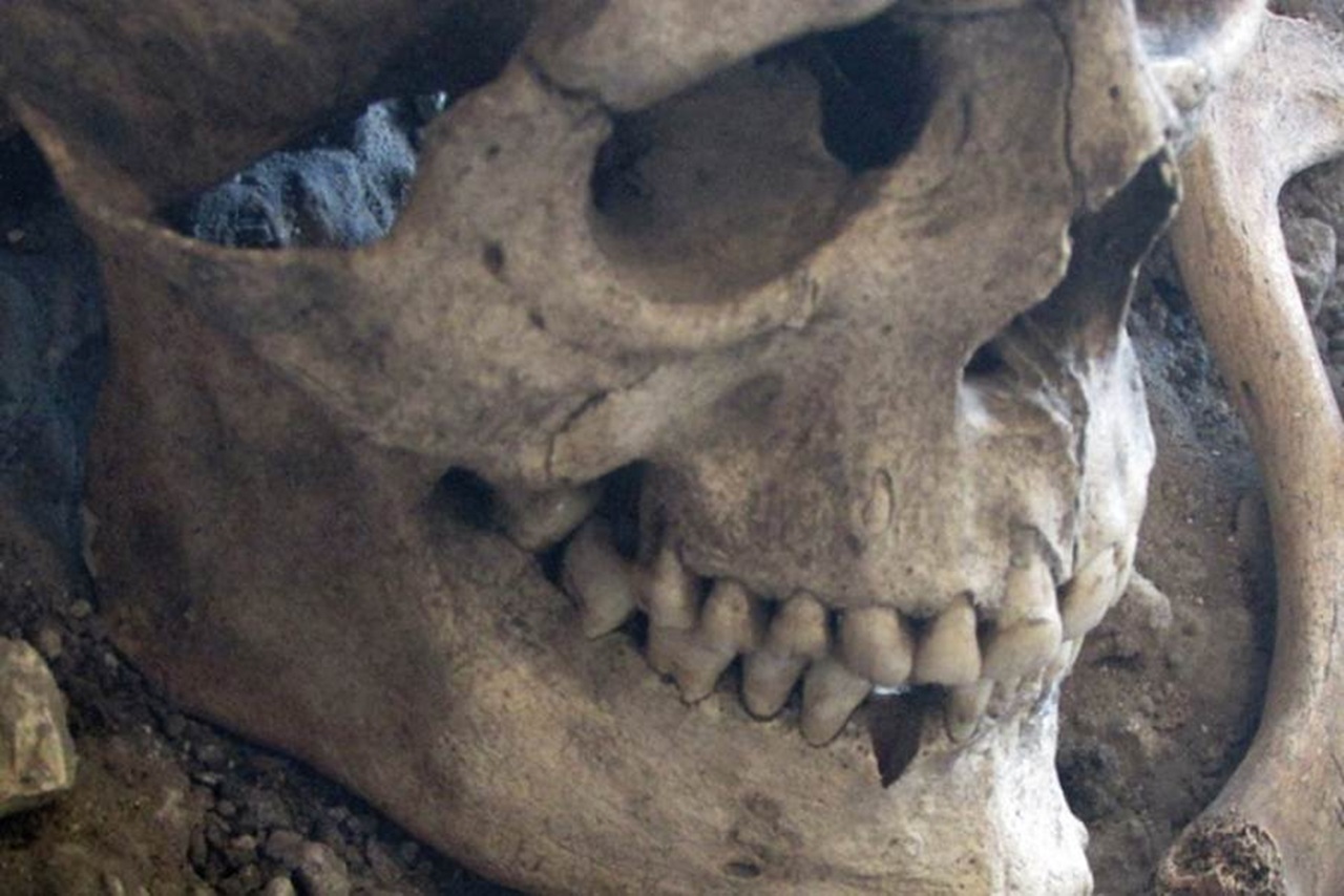 massacro teschio