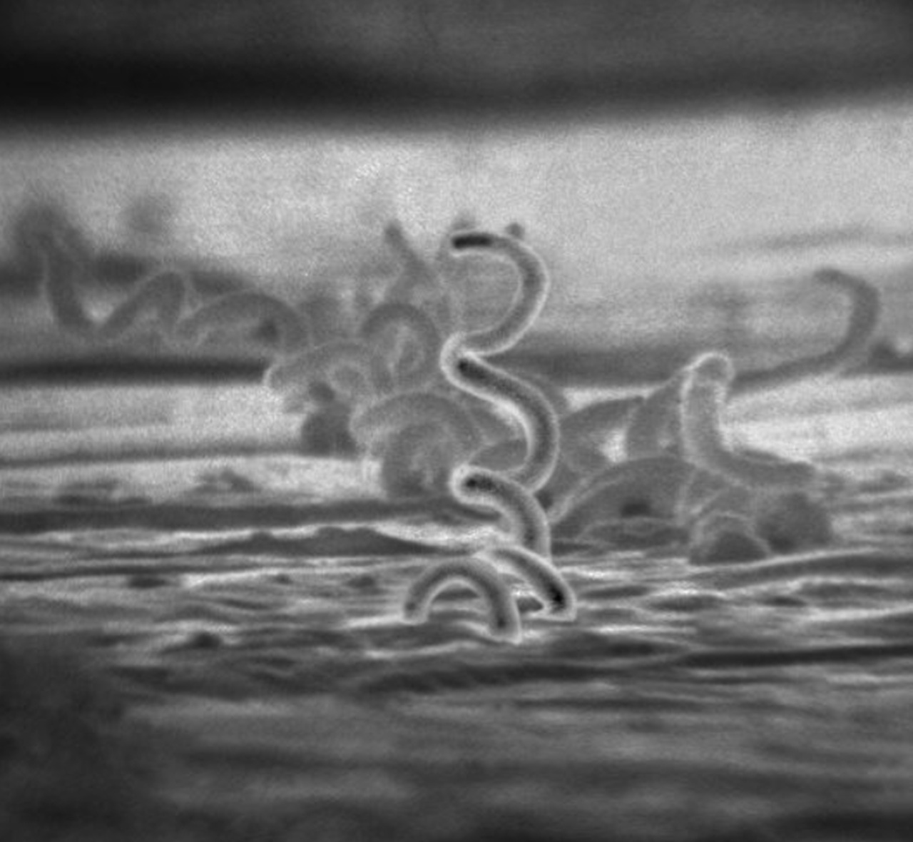 Malaria sifilide