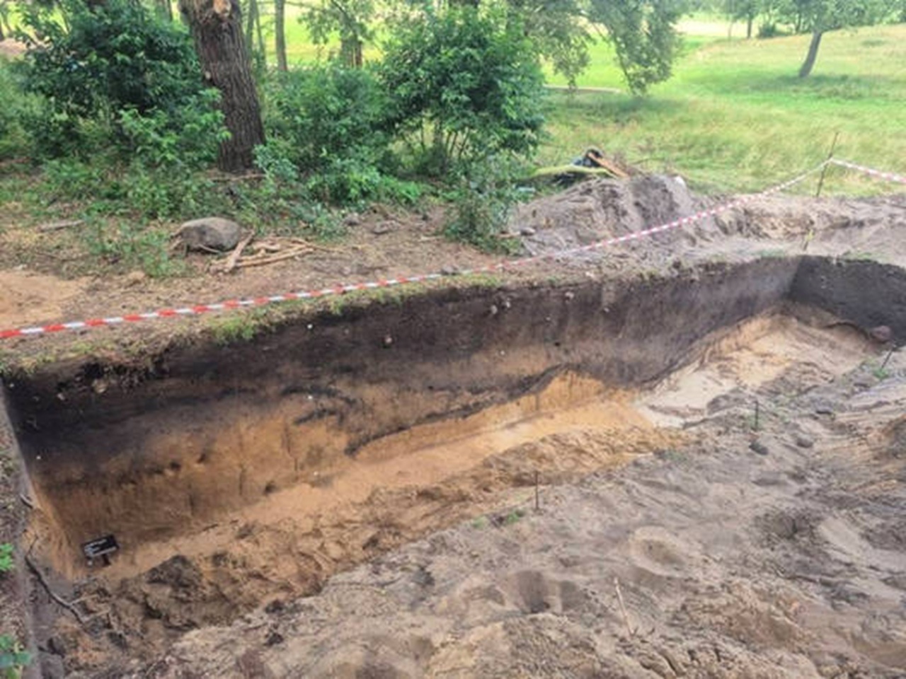 neurochirurgia forte