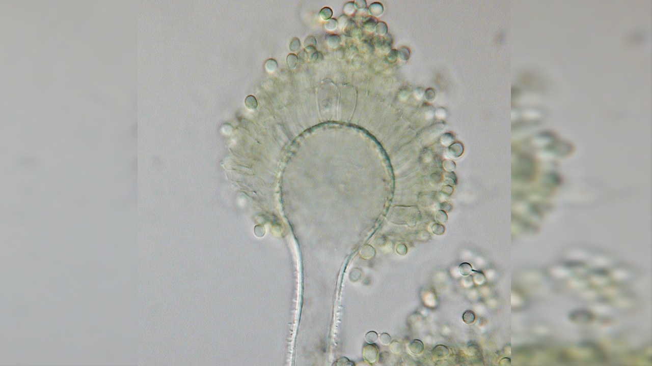 aspergillus flavus
