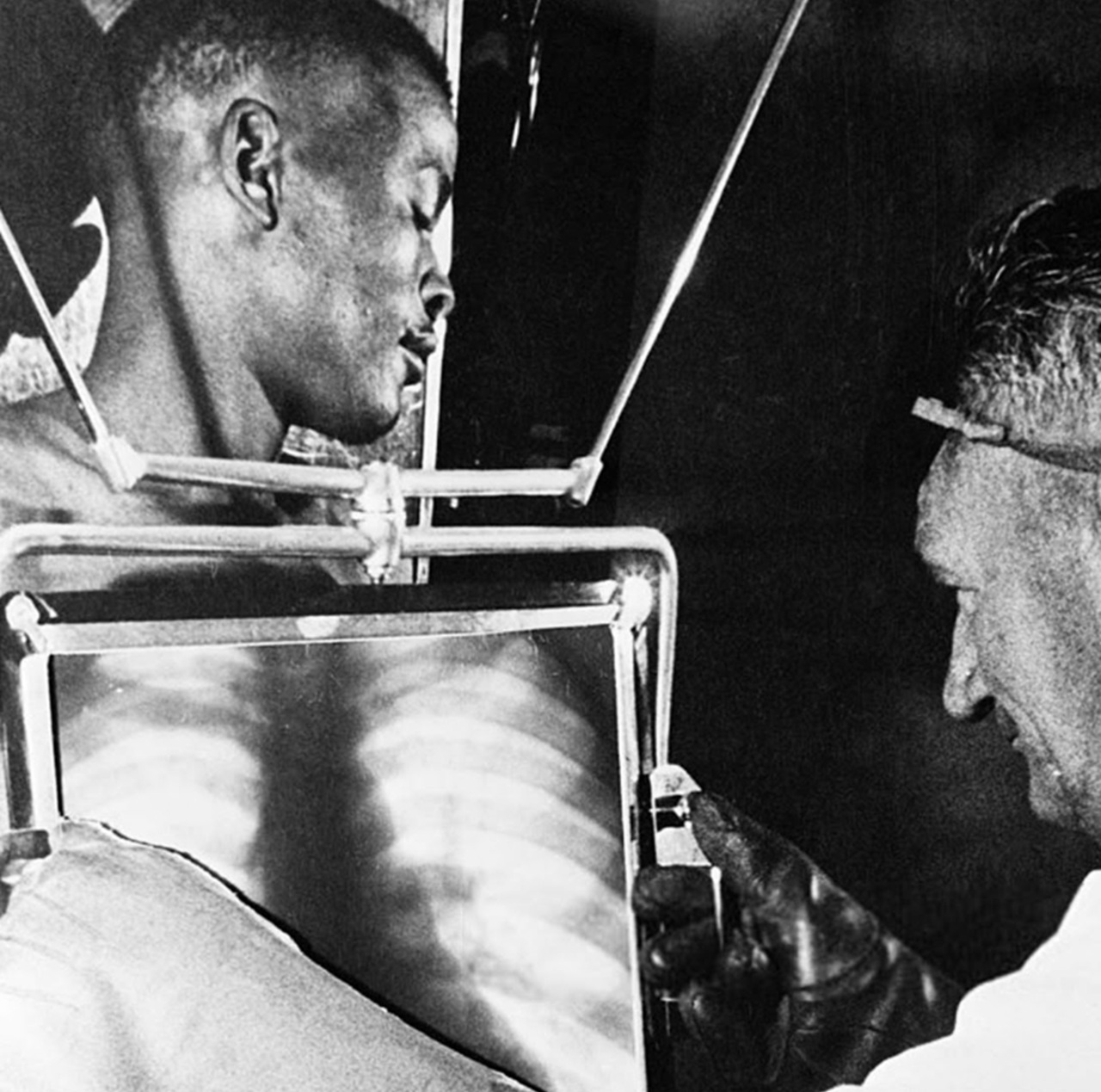 raggi X 1954 minatore