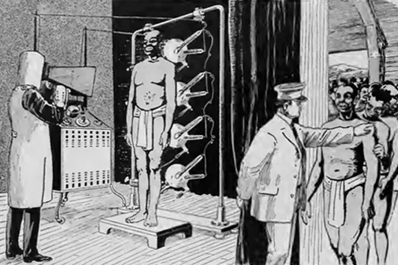 raggi X raffigurazione fluoroscopio 1919