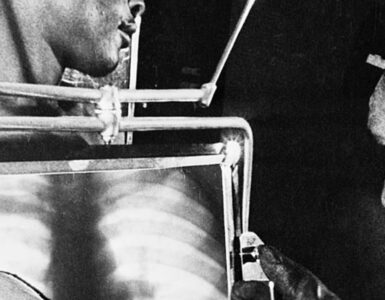 Foto del giorno: diamanti e raggi X