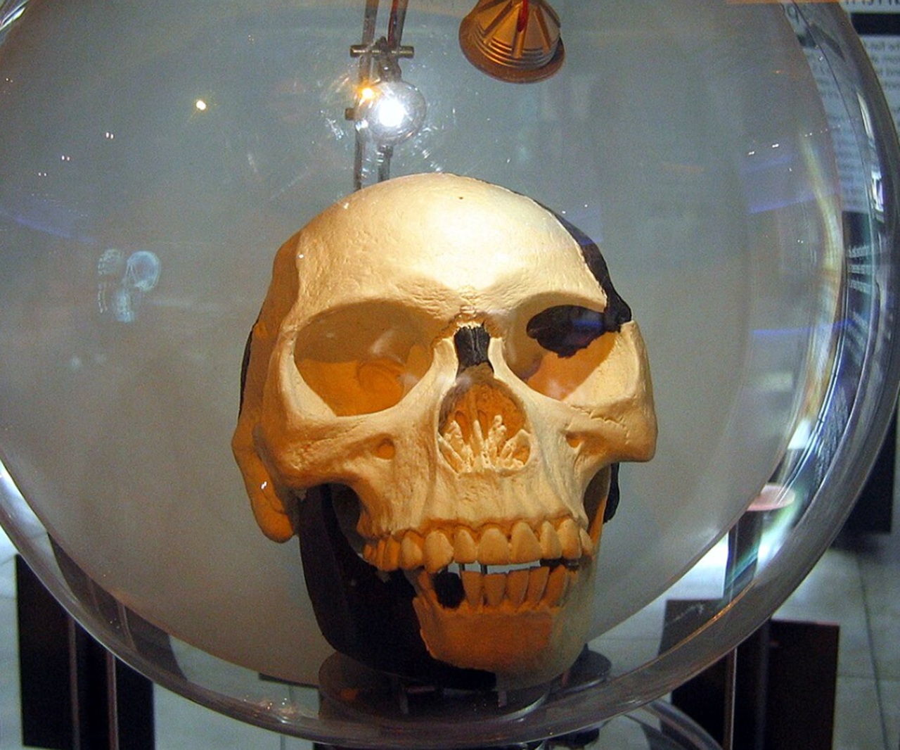 uomo di Piltdown resti conservati