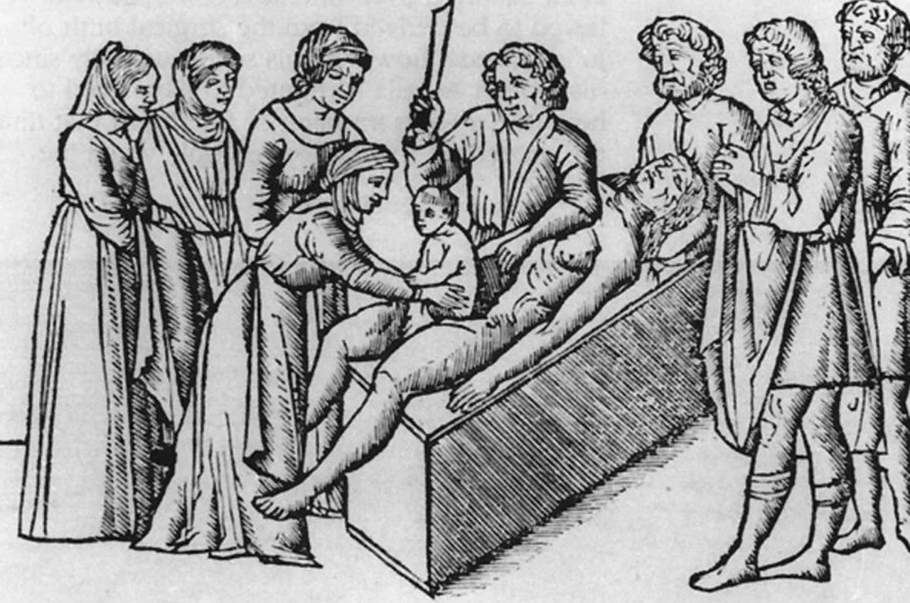 taglio cesareo cesare