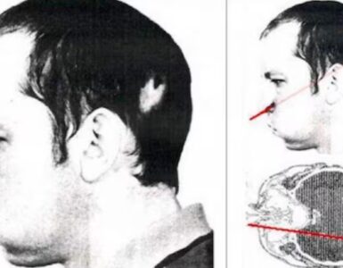 Anatolij Bugorskij, il fisico russo sopravvissuto ad un fascio di protoni