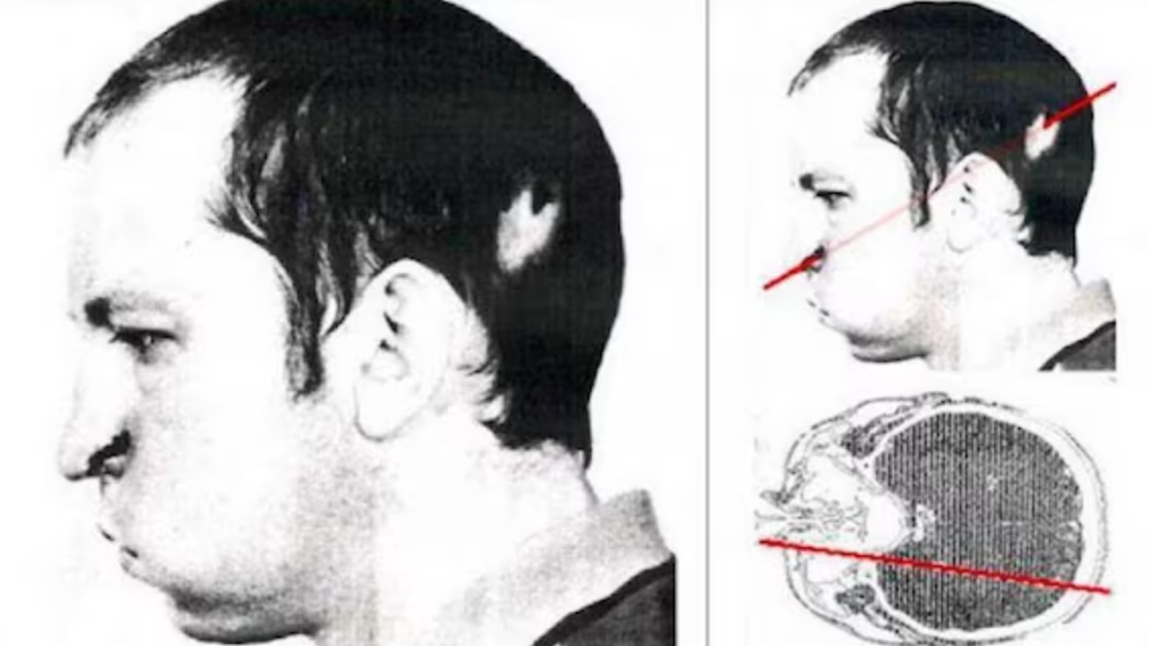 Anatolij Bugorskij, il fisico russo sopravvissuto ad un fascio di protoni