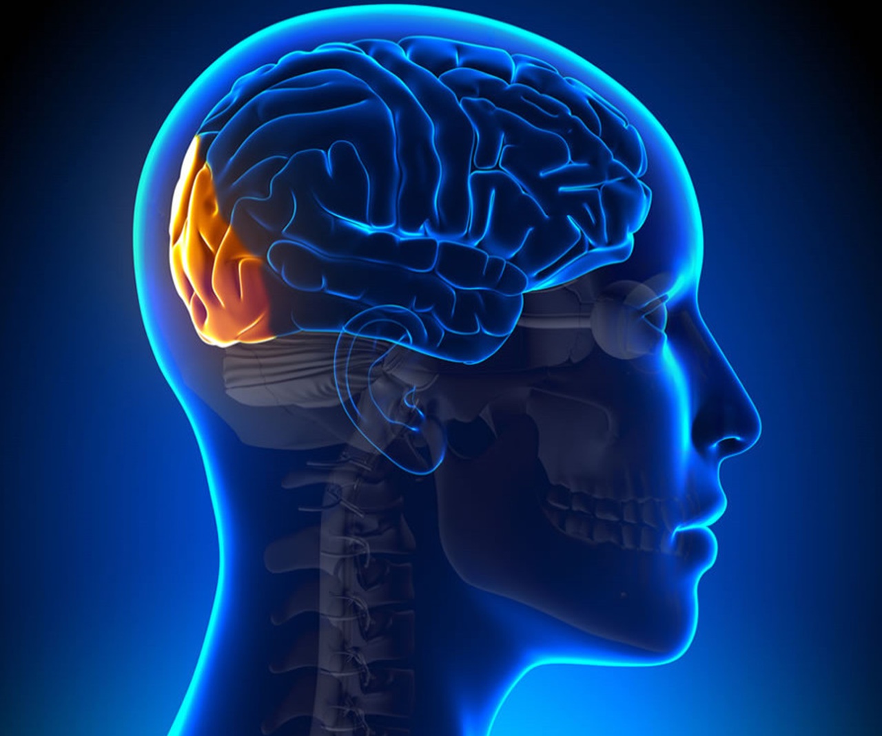 paziente M parete occipitale