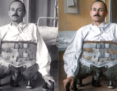 Foto del giorno: Dominikus Müller, reduce di guerra