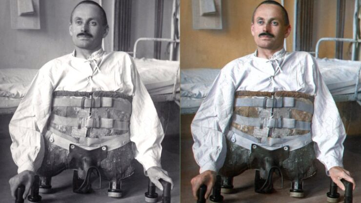 Foto del giorno: Dominikus Müller, reduce di guerra