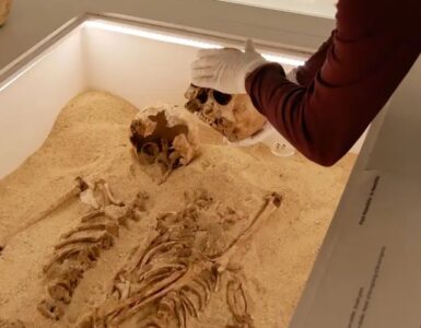 antico dna malattia genetica