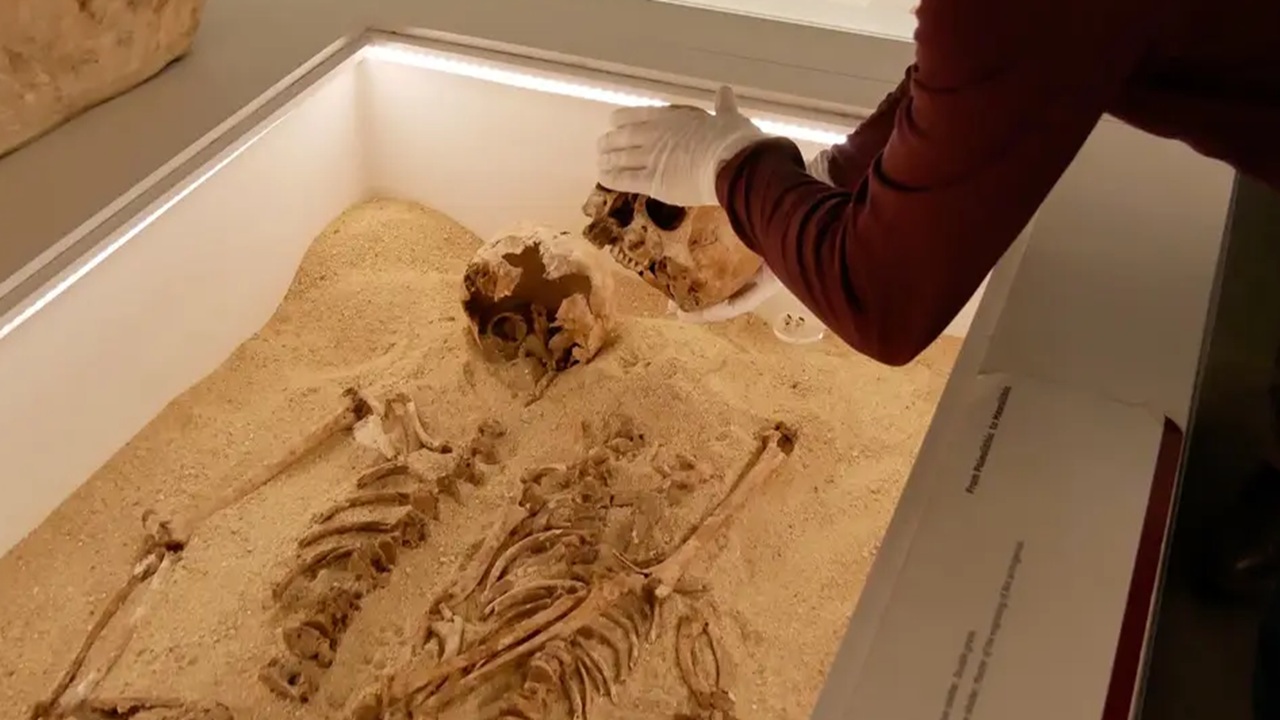 antico dna malattia genetica