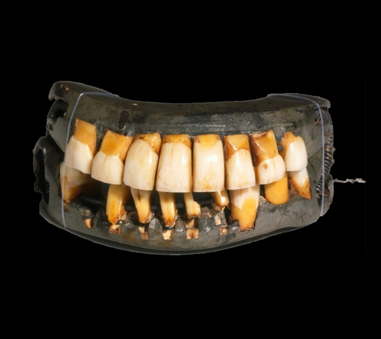 scucchia progenismo mandibolare Washington